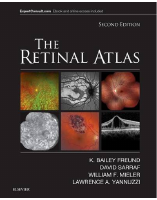 THE RETINAL ATLAS 2nd Edition Part 2.pdf